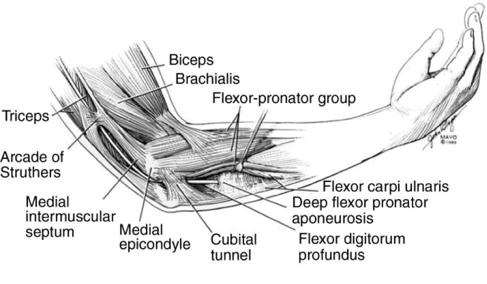 cubital tunnel image 2